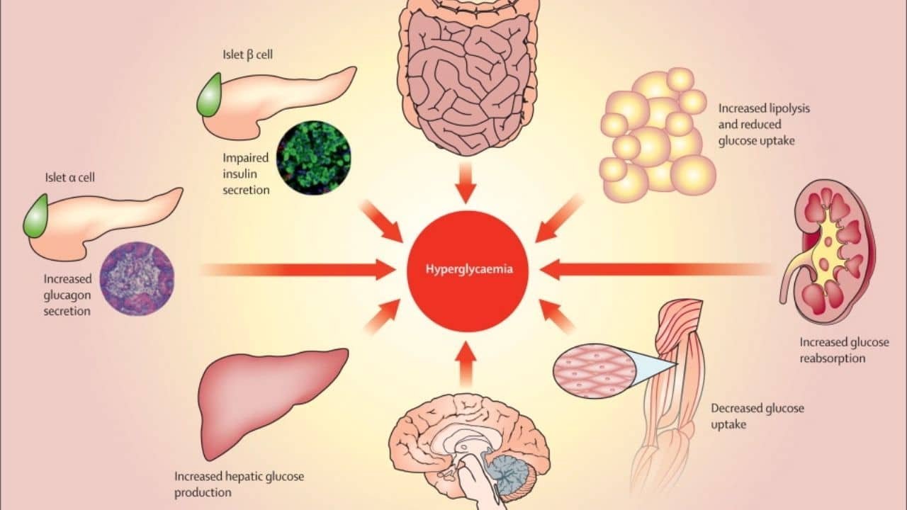 Treatment and Management